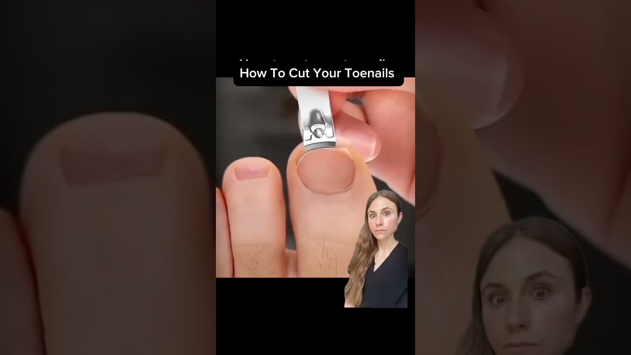 Never Get Another Ingrown Toenail With This Simple Fix #dermatologist
