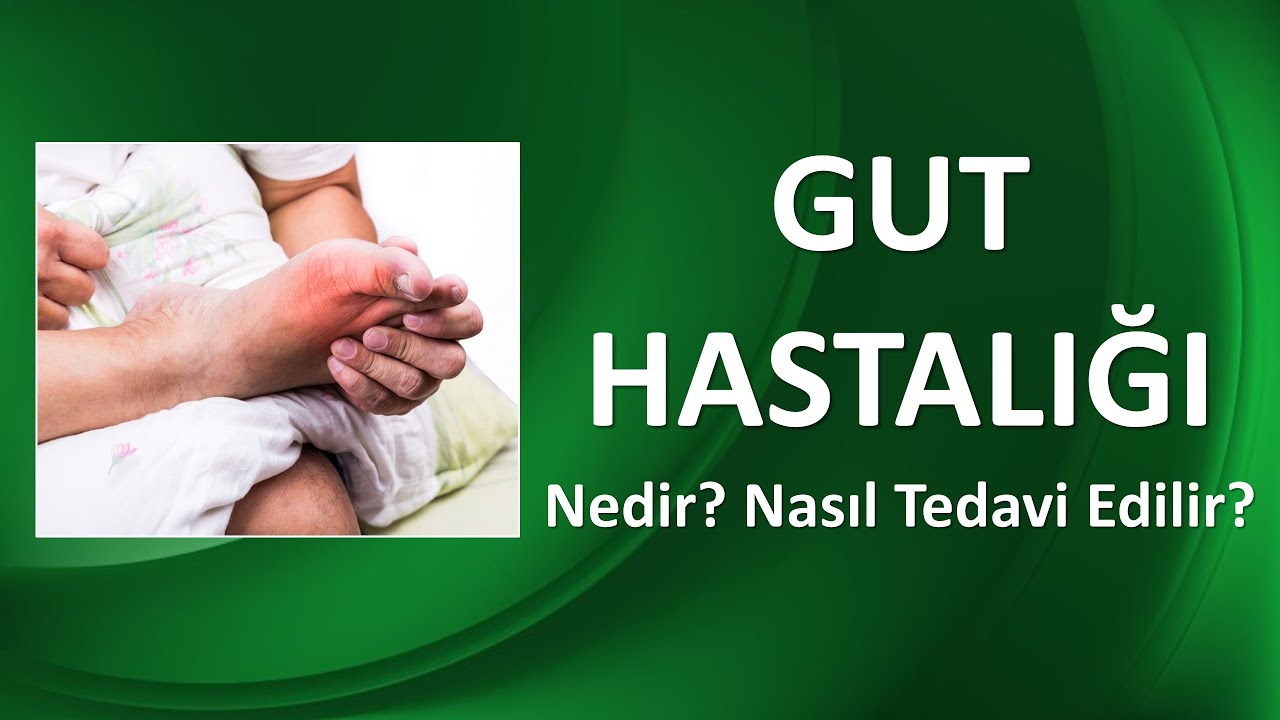 GUT HASTALIĞI Nedir, Nasıl Tedavi Edilir?