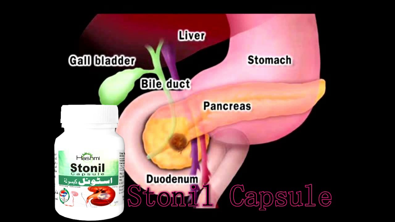 Hashmi Kidney Stone Treatment Stonil Capsules