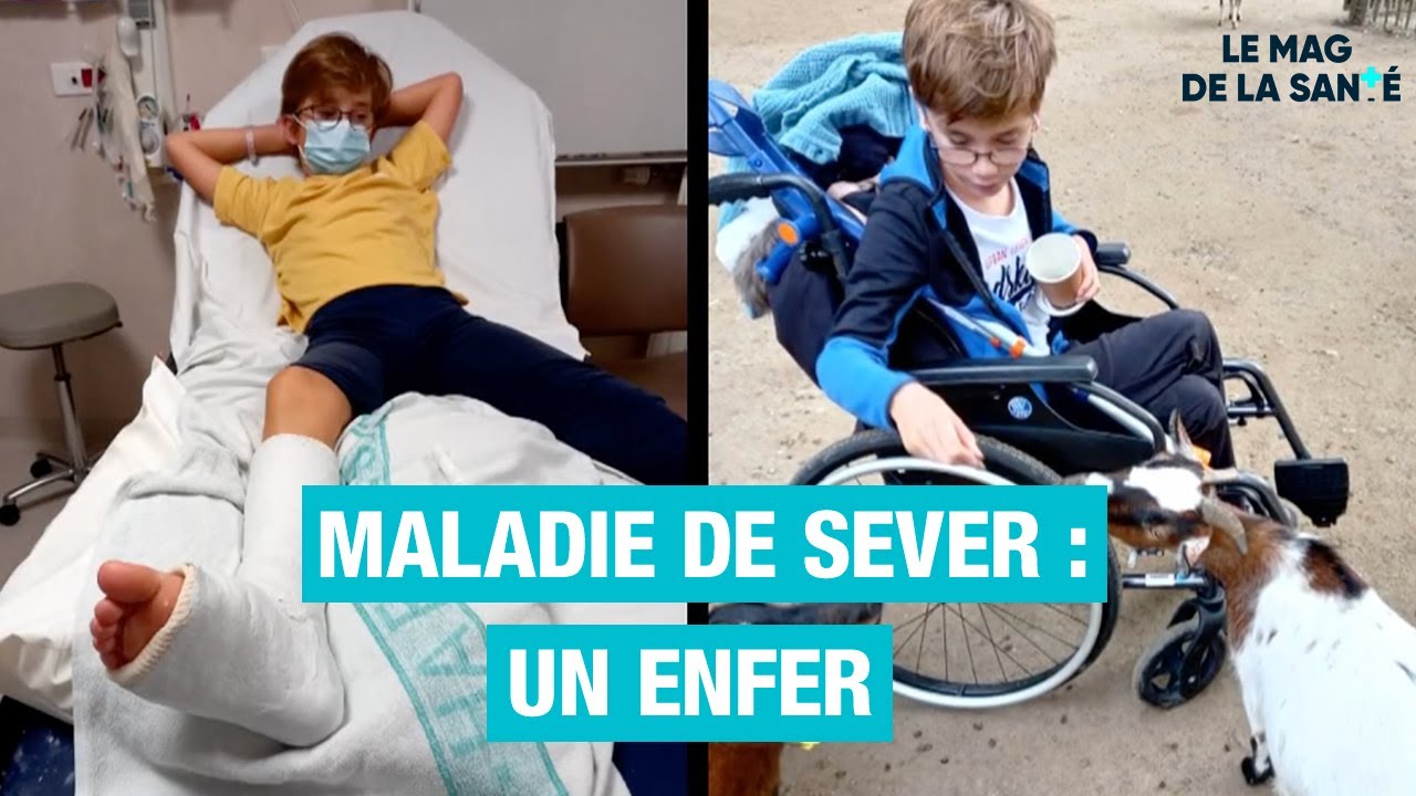 La maladie de SEVER chez les enfants 👦 - Allo Docteurs