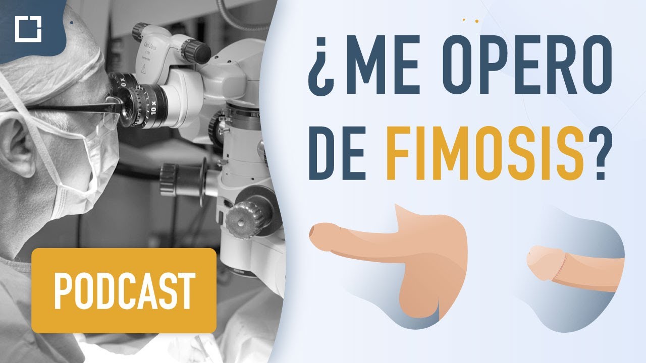 ¿Cuándo operar de FIMOSIS (quitar el prepucio) y cuándo no ? [PODCAST]