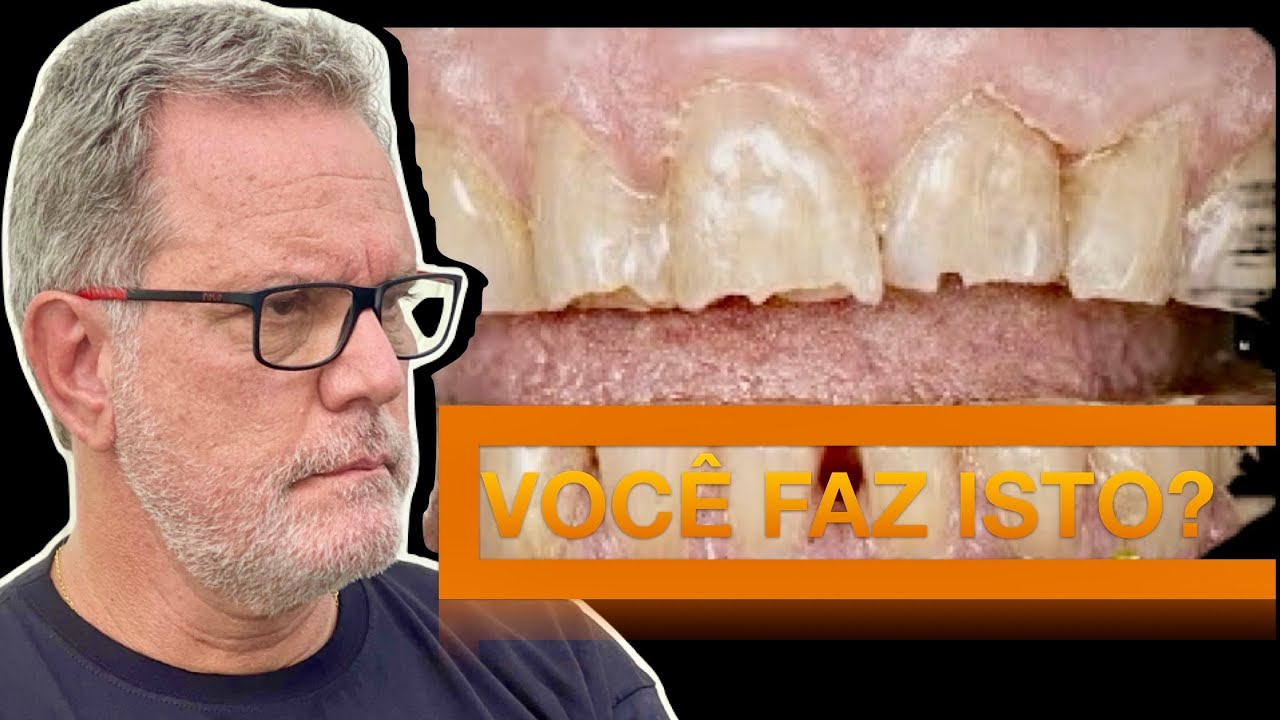 Bruxismo: Quando a mente fala pelos dentes 