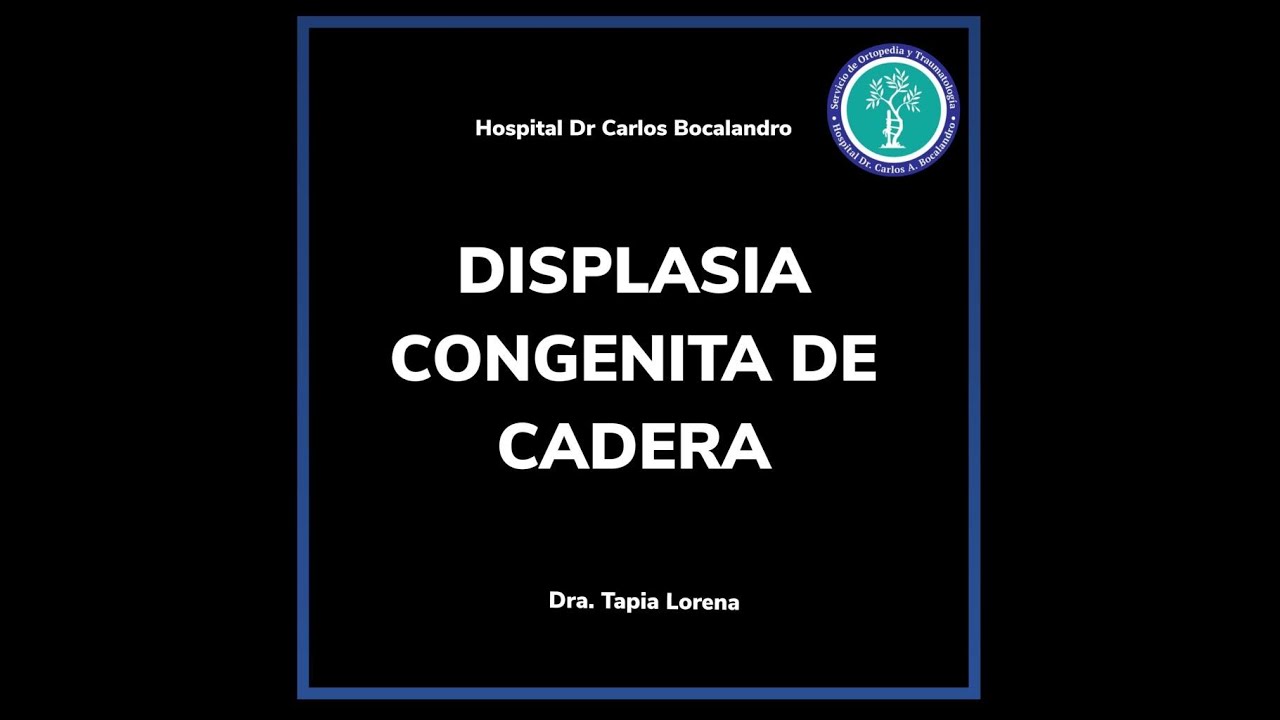 Displasia congénita de cadera