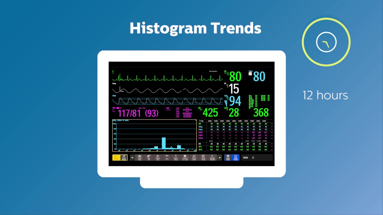 Empowerment: Visualizing critical patient information in the ICU