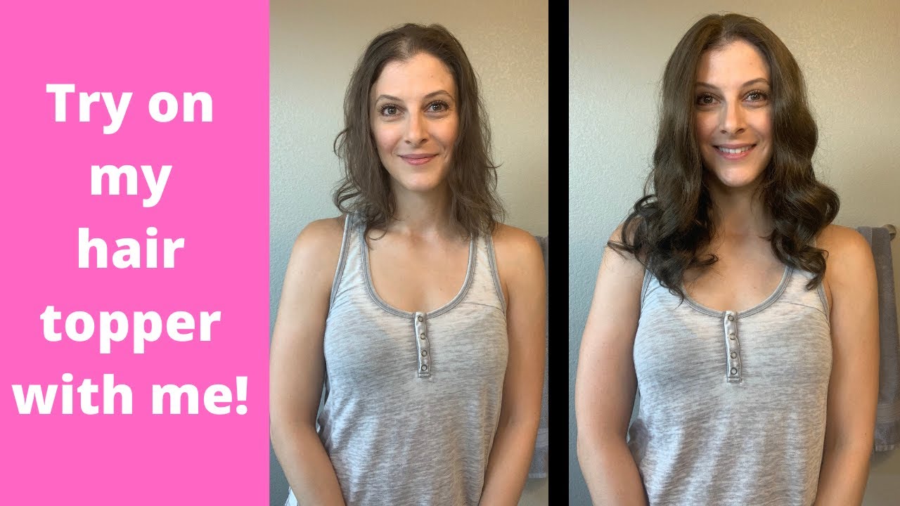 Trying the Hair Topper from Uniwigs! \\ Hair Loss Journey