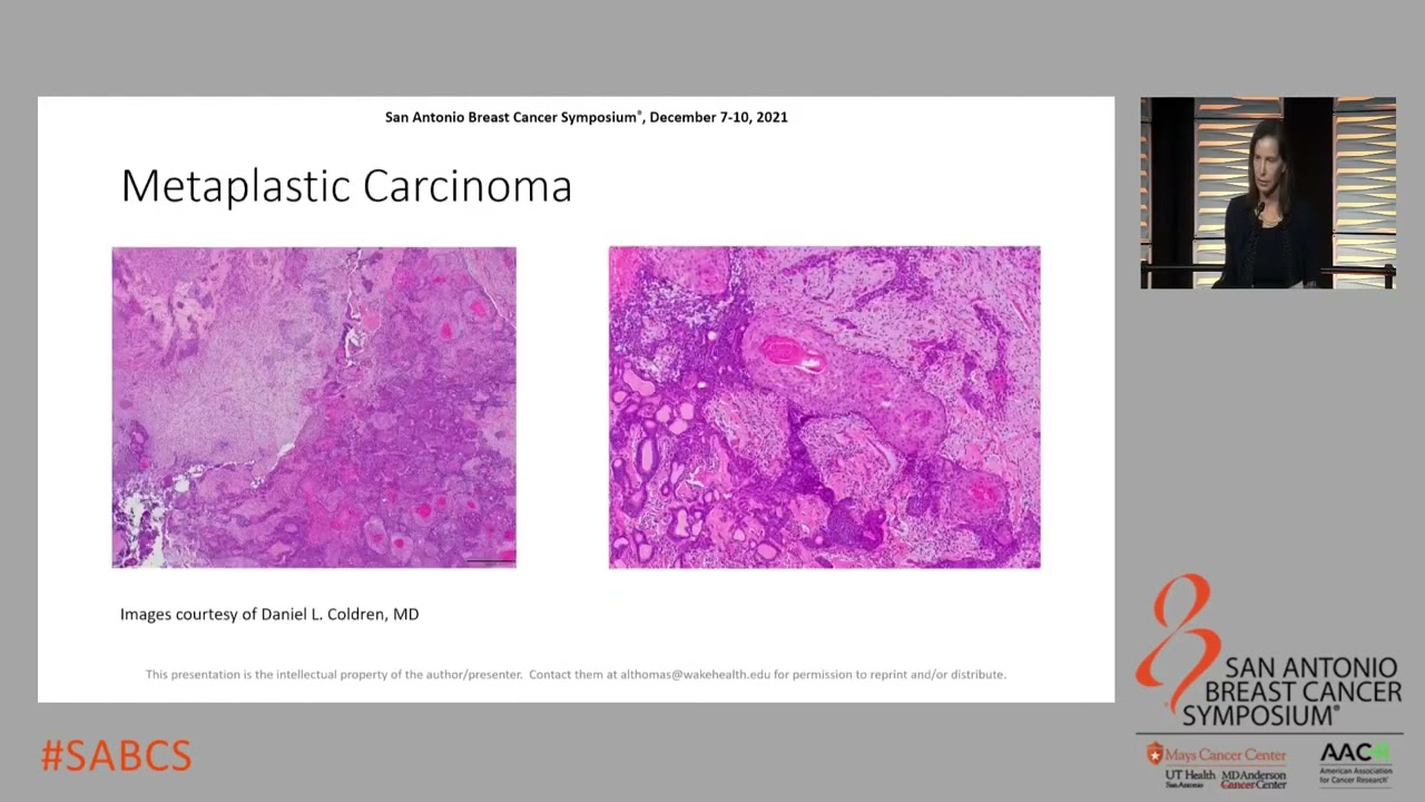 SABCS 2021: Management of special subtypes of TNBC