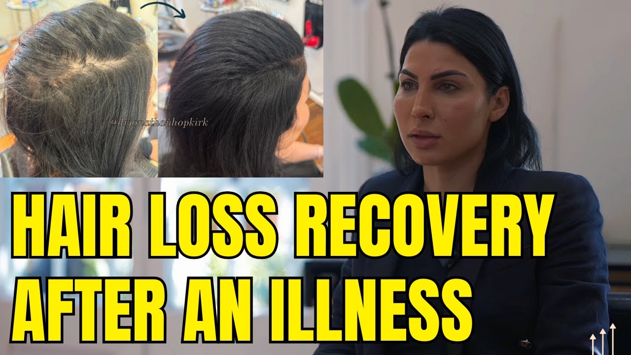 Telogen Effluvium After Illness? Her Hair Fell Out&mdash;Here&rsquo;s How We Got It Back