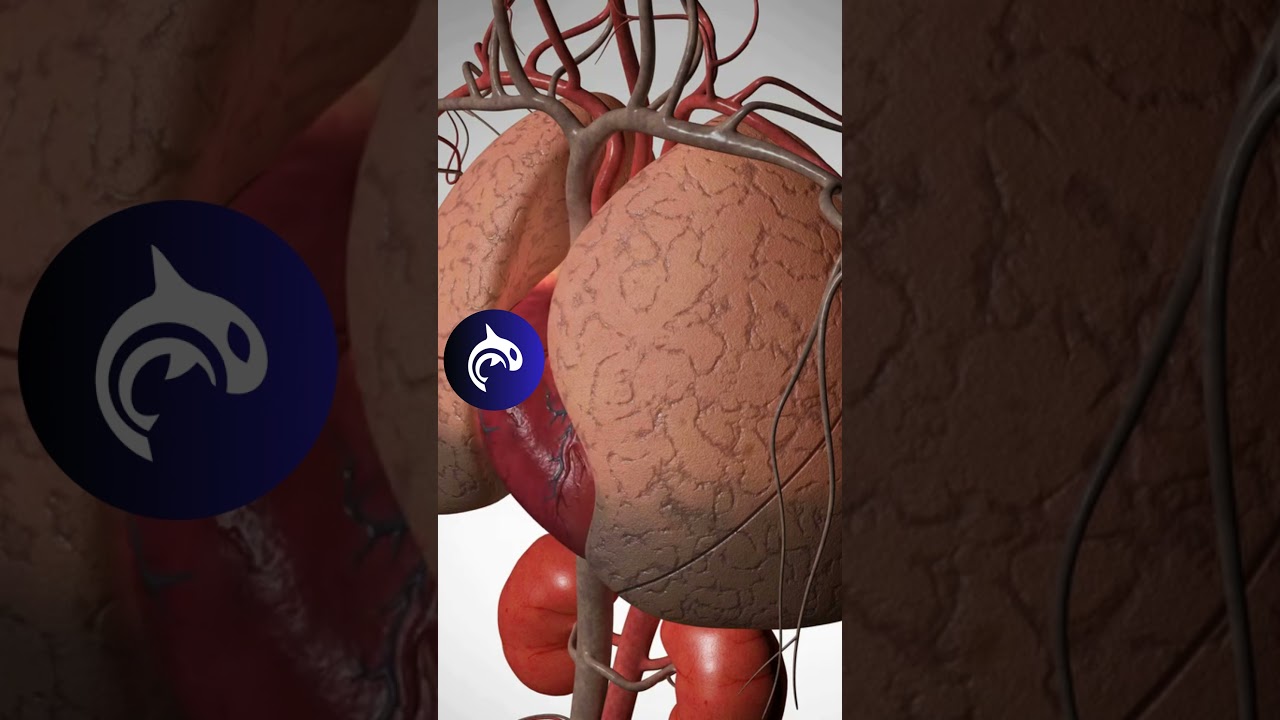 Heart Failure - See What Happens - 3D Animation
