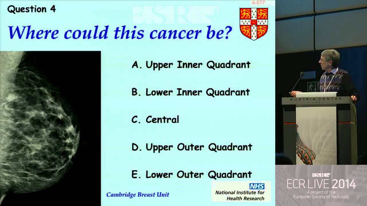 ECR 2014 Digital mammography: technique and quality assurance, M.G. Wallis;  Cambridge/UK