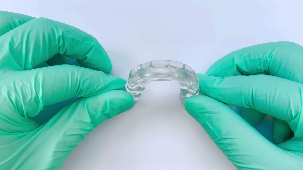 What is a hard splint nightguard?