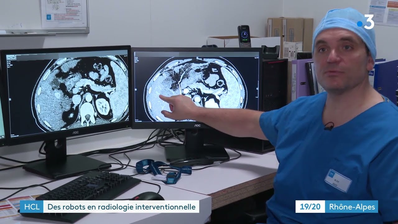 Des robots en radiologie interventionnelle  - France 3