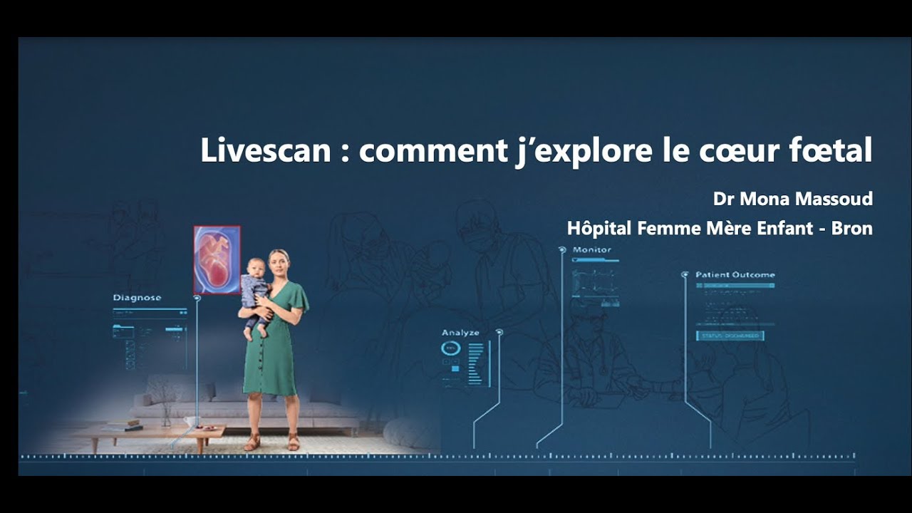 Livescan 