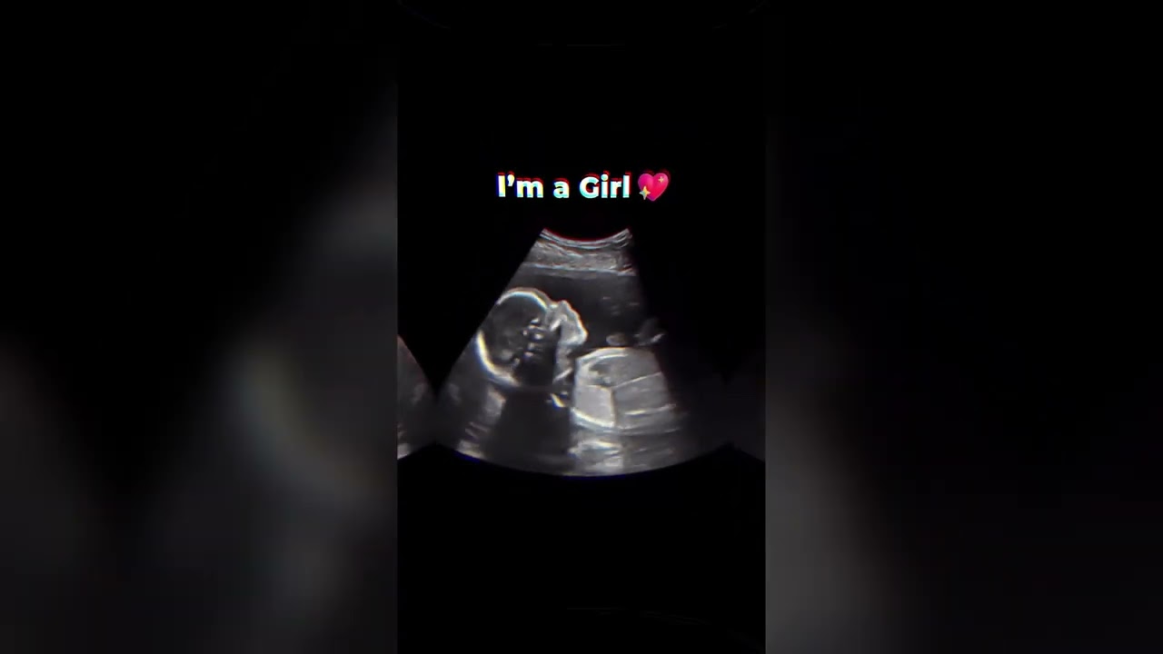 AI Gender Reveal app nubx #pregnant #babygender #pregnancy