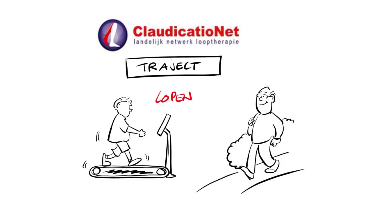 Etalagebenen (claudicatio intermittens) informatievideo De Rooy Fysiotherapie.