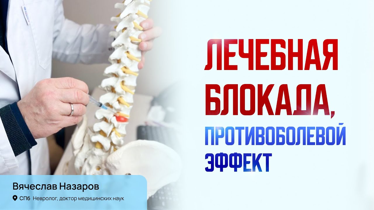 Противоболевое действие блокады. Лечение острой и хронической боли в спине. Невролог д.м.н. СПб.
