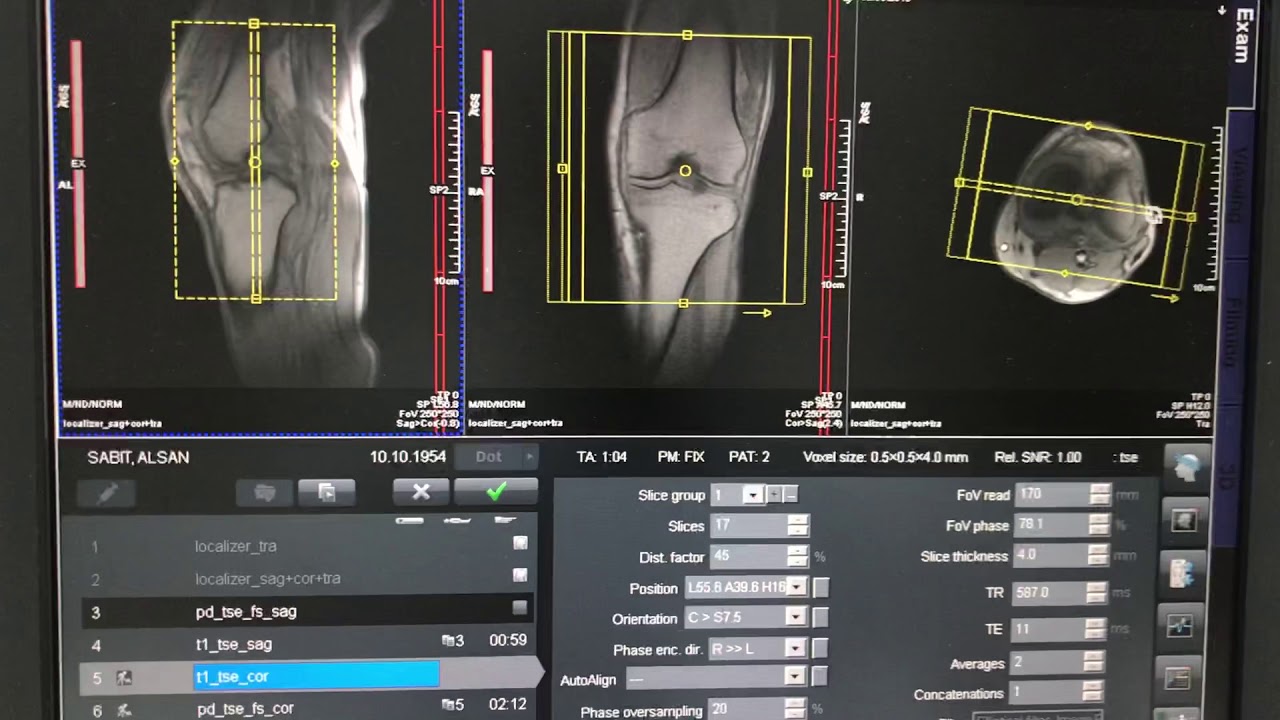 Diz Mr Nasil Çekilir? Siemens Magnetom Essenza Mr Ögreniyorum