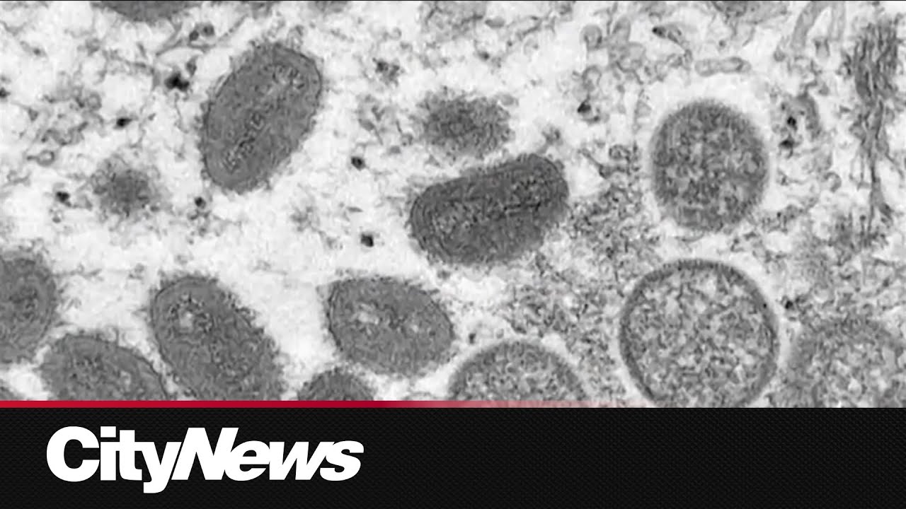 WHO declares mpox outbreak a global health emergency