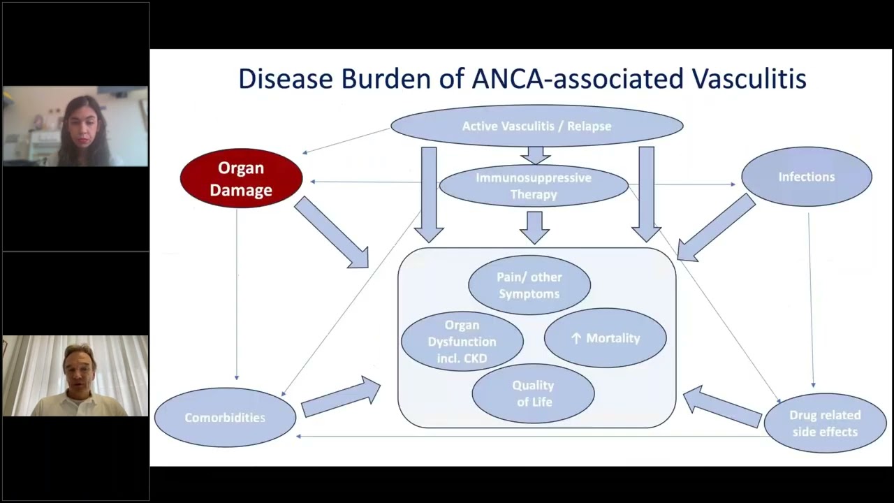 Innovative treatments for vasculitis | Tuesday Lunch with RITA and EUVAS