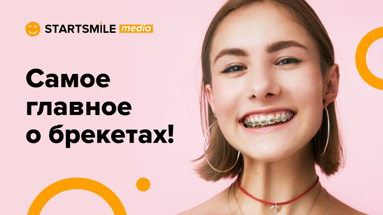 Брекеты для зубов - Виды, установка, цена и альтернативное лечение