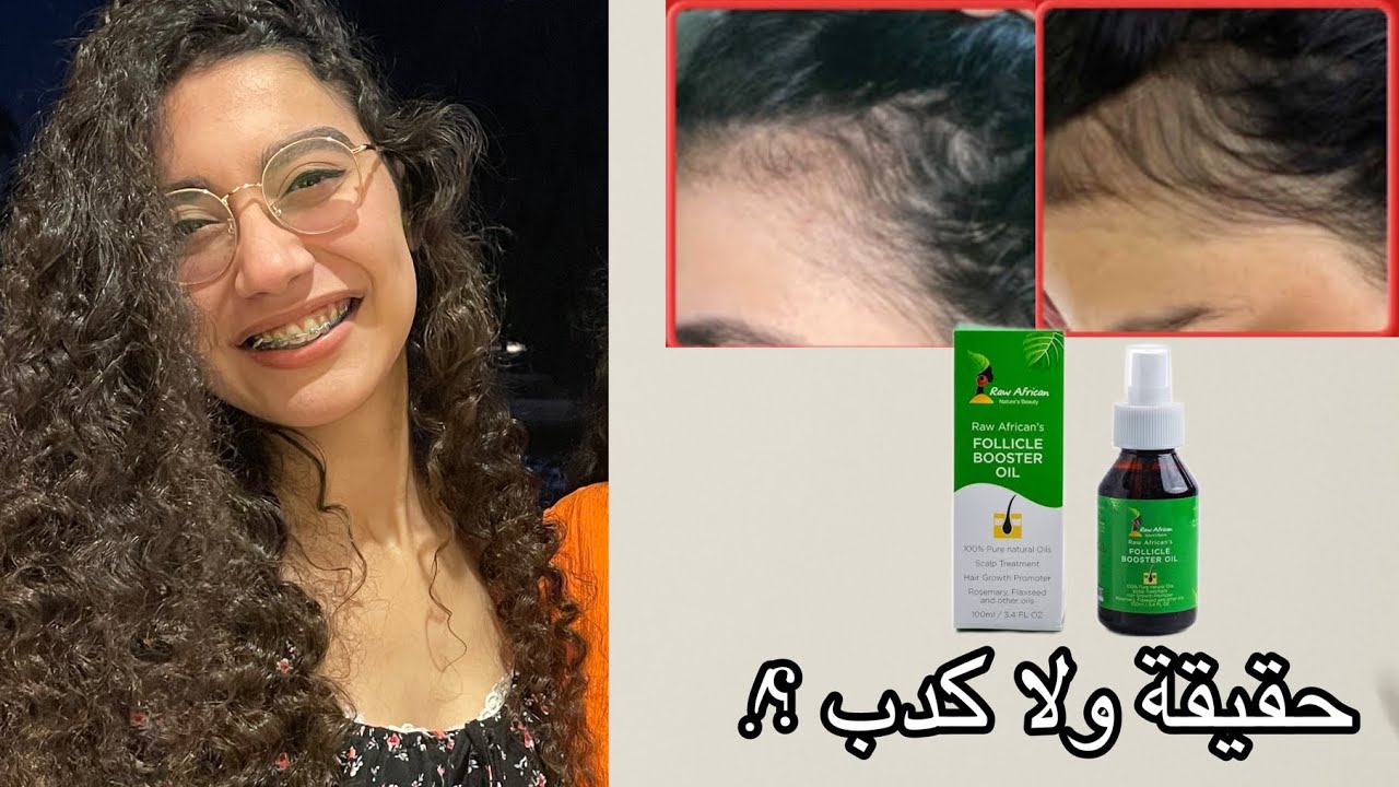 Raw African follicle booster hair oil | زيت رو افريكان لانبات و تطويل الشعر حلو فعلا ولا لا ؟!