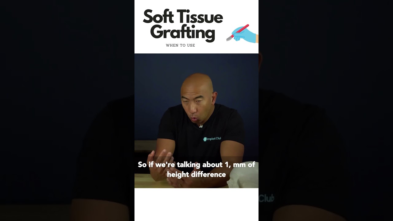 When to use soft tissue grafting around implants