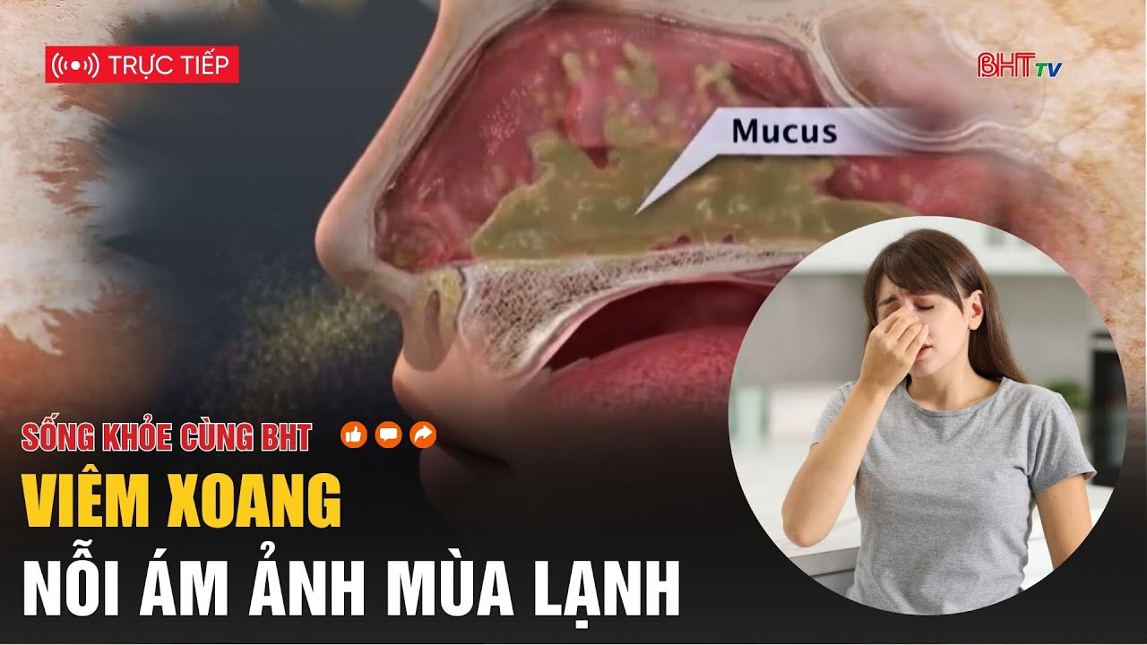 🔴 Sống khỏe cùng BHT: Viêm xoang - nỗi ám ảnh mùa lạnh