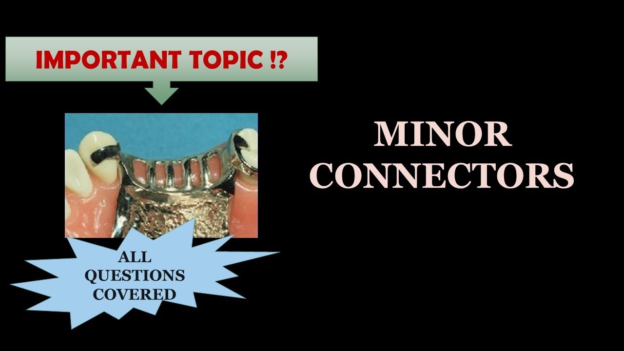 MINOR CONNECTORS / Removable Partial Denture / RPD