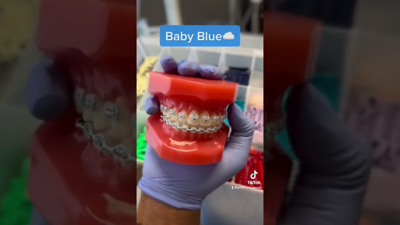 Braces colors you should be getting!🤩✨ #jeffersondental #braces #bracescolors #bestbraces