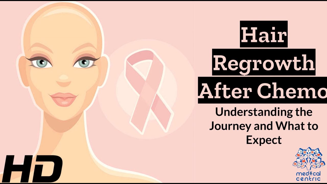 Hair Rebirth: The Remarkable Journey After Chemo