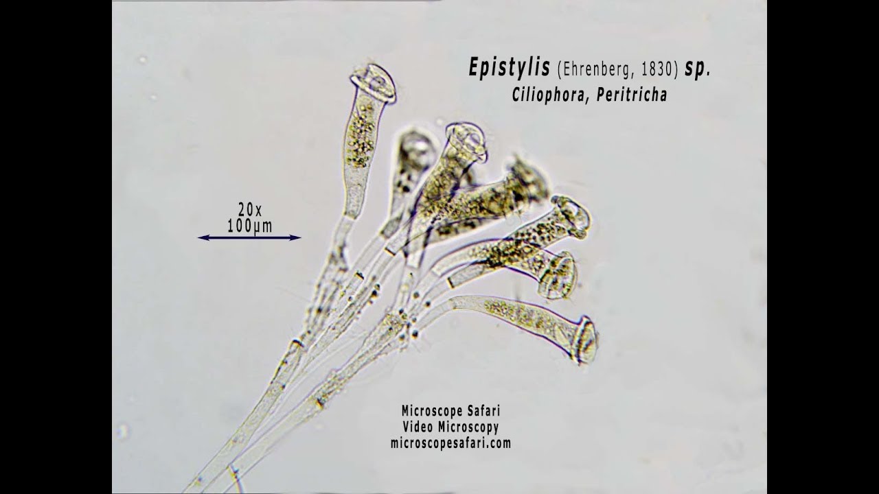 Epistylis sp Vid