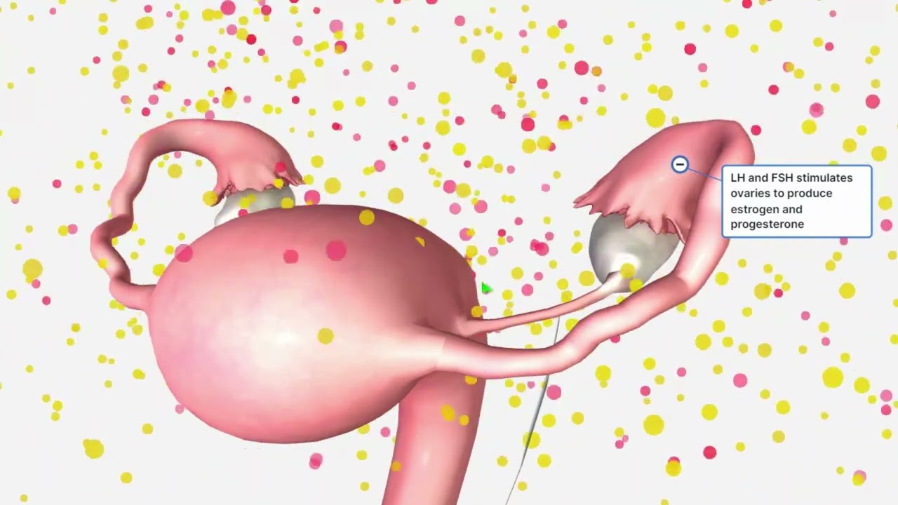Central Precocious Puberty Female
