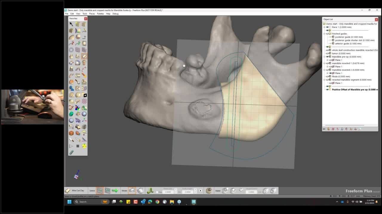 Webinar: Redefining patient specific 3D design with Geomagic Freeform