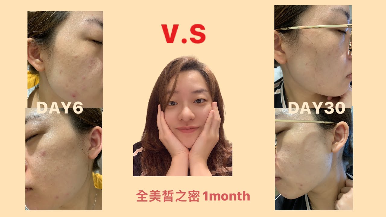 全美皙之密使用體驗 直銷？好用嗎？第30天的保養順序大公開