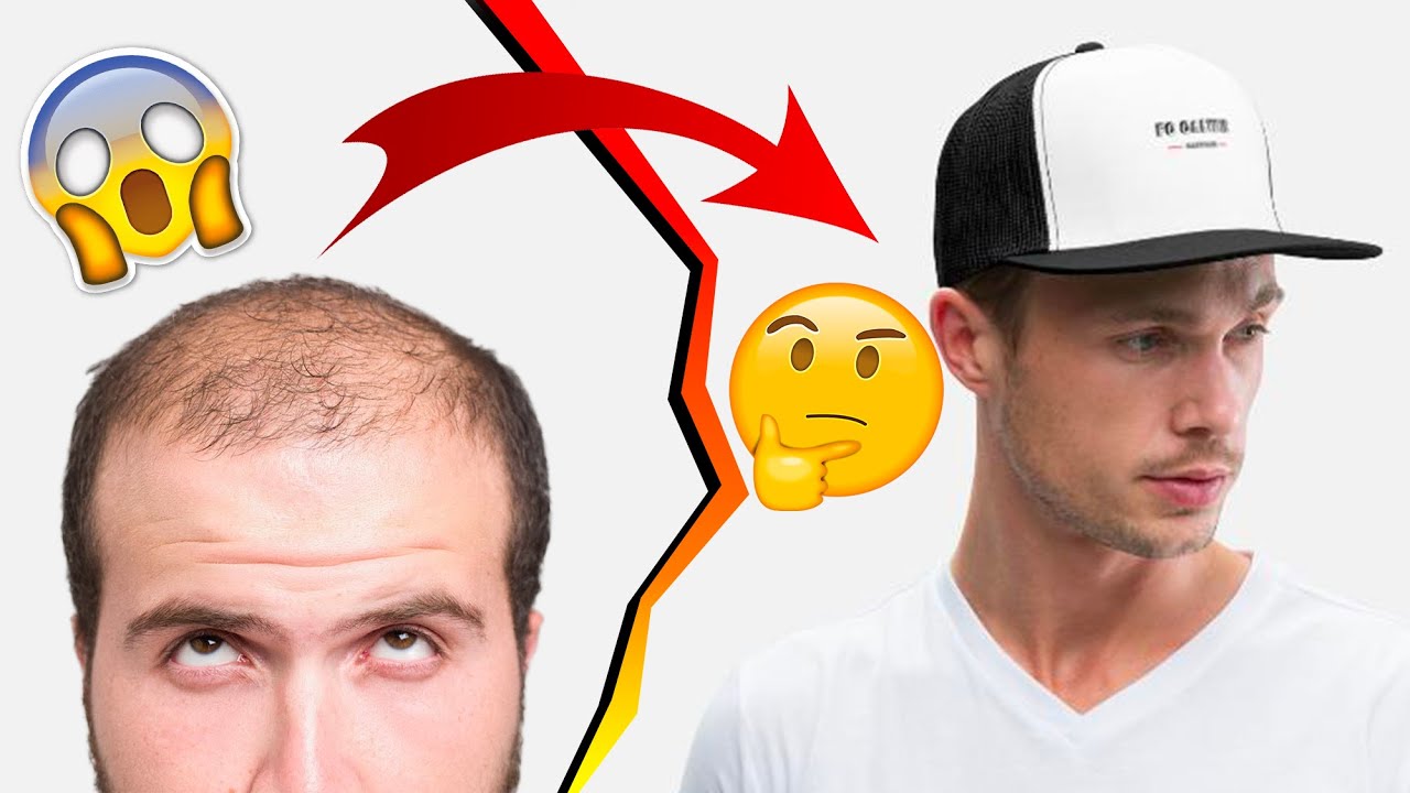LA CASQUETTE FAIT ELLE PERDRE SES CHEVEUX ?
