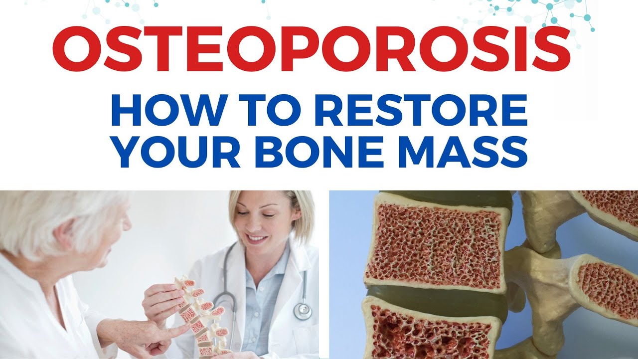 Osteoporosis: The MOST Important Strategies For Healthcare Practitioners