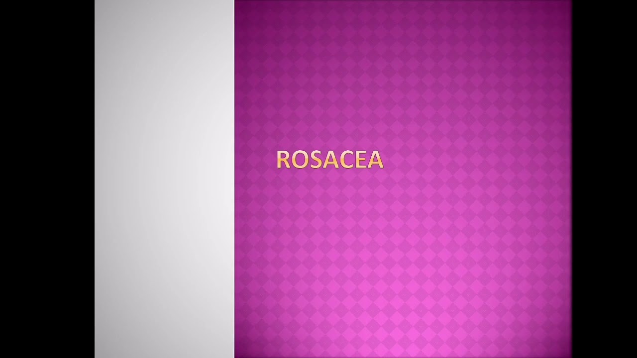 Rosacea seminar by dr Amer al homsi