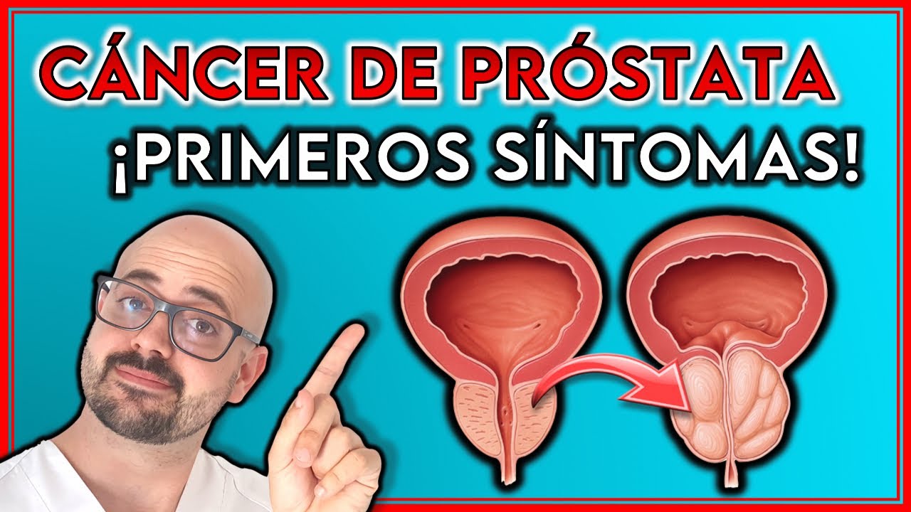 ESTOS son los 7 PRIMEROS S&Iacute;NTOMAS del C&Aacute;NCER DE PR&Oacute;STATA ||&iexcl;SE&Ntilde;ALES que NO debes IGNORAR!