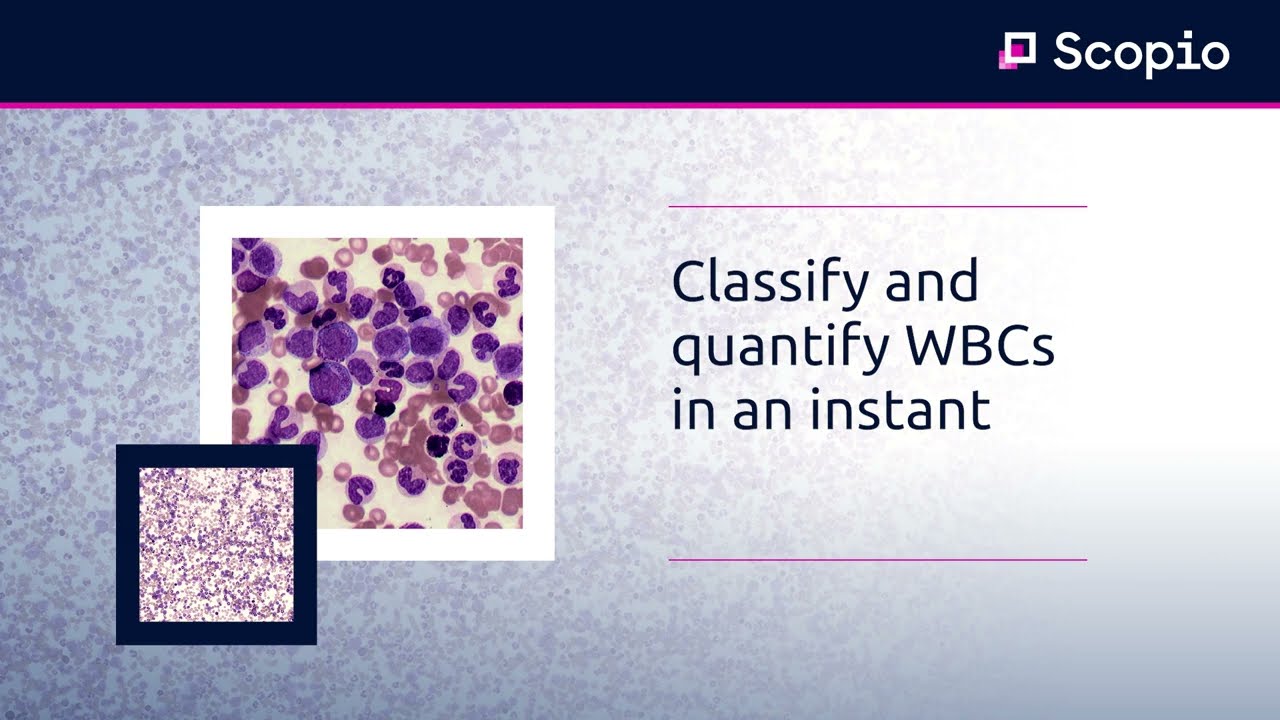 WBC Classification with AI Decision Support | Scopio Labs