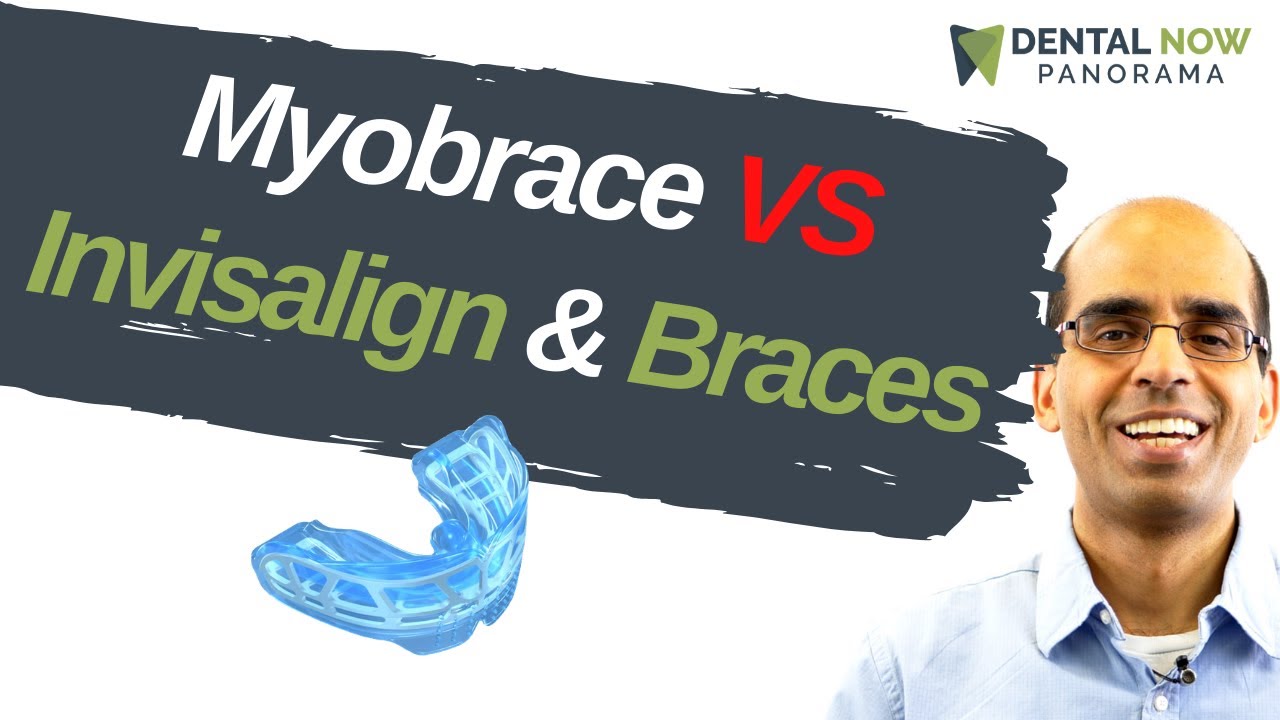 Myobrace compared to Braces and Invisalign | Dentist Explained (2021)