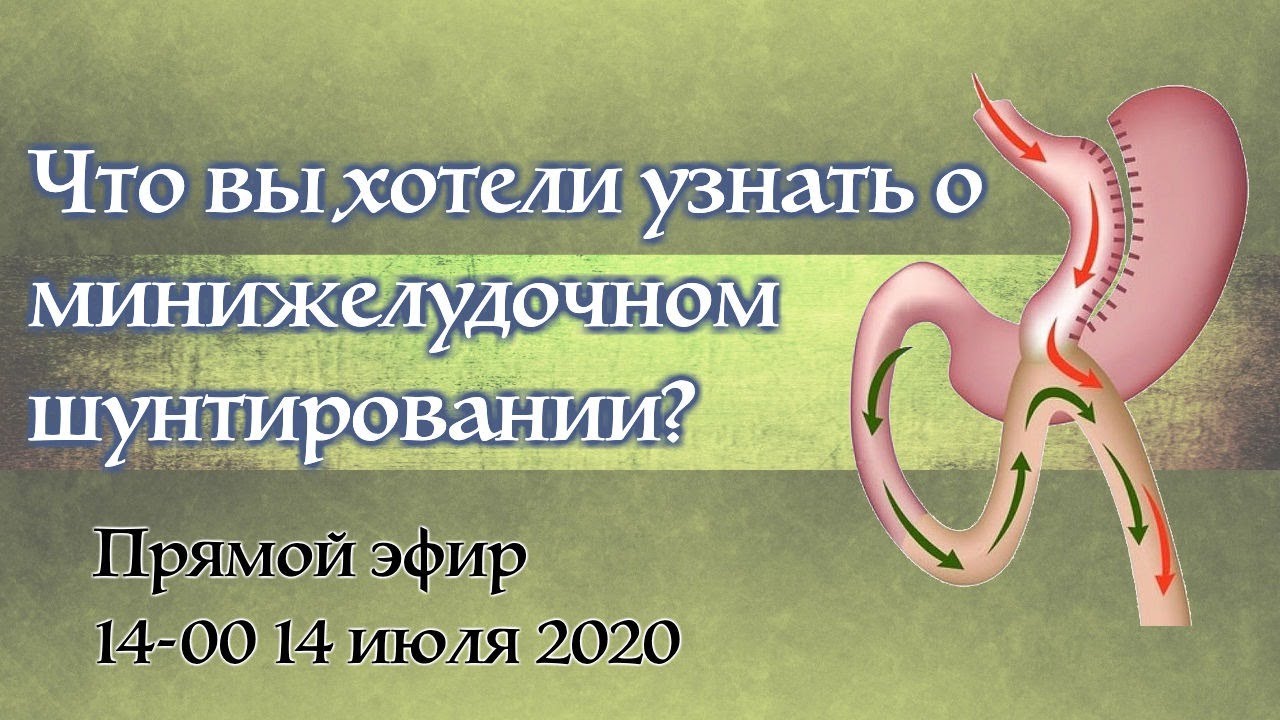 Минижелудочное шунтирование (mini gastric bypass, минишунт, OAGB)