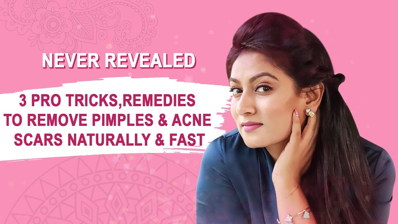 3 PRO TRICKS, REMEDIES TO REMOVE PIMPLES & ACNE MARKS NATURALLY & FAST  || Ashtrixx