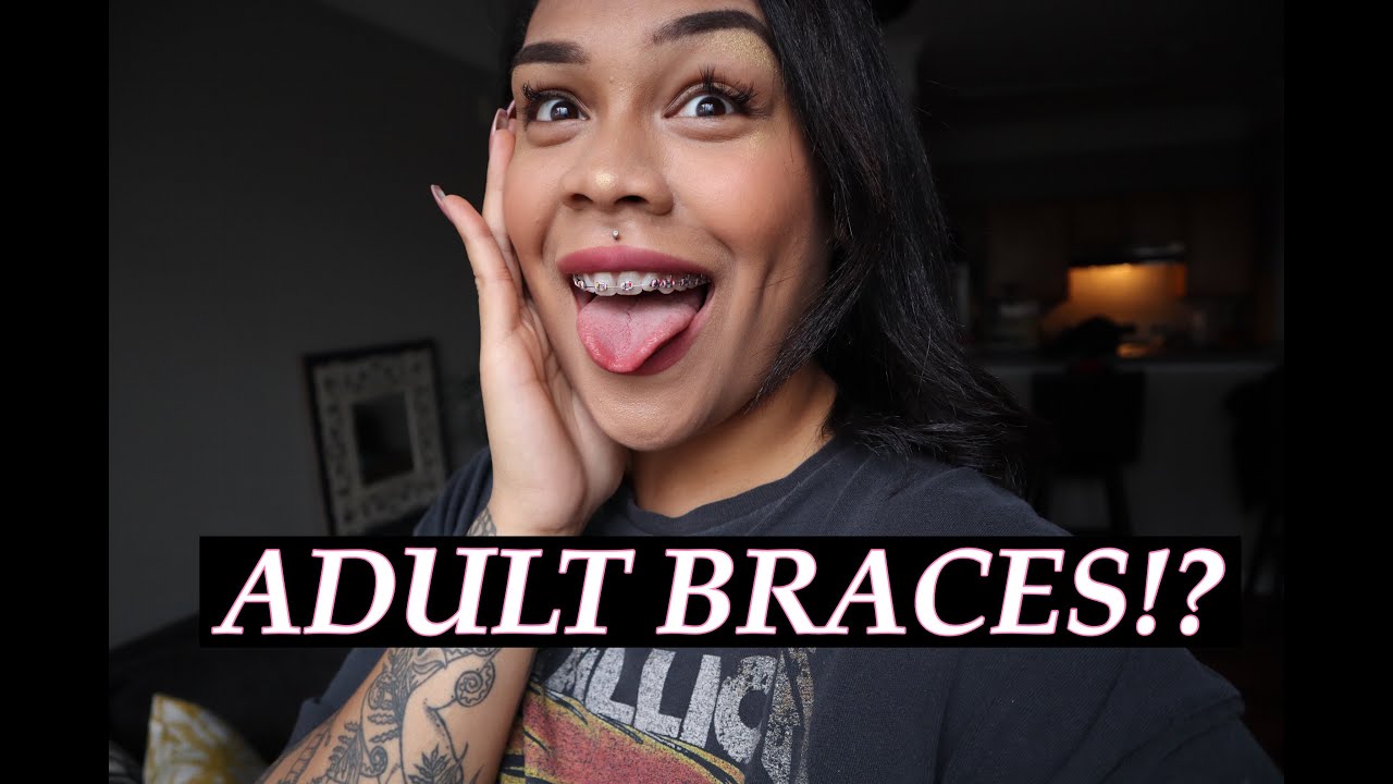 SELF LOVE JOURNEY: THE REASON I GOT BRACES AS AN ADULT