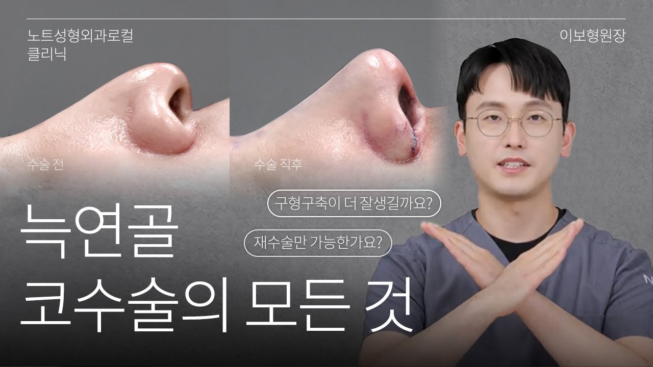 [이보형 원장의 Q&A] 기증늑 vs 자가늑  l 구축 확률 l 코재수술 l 노트성형외과