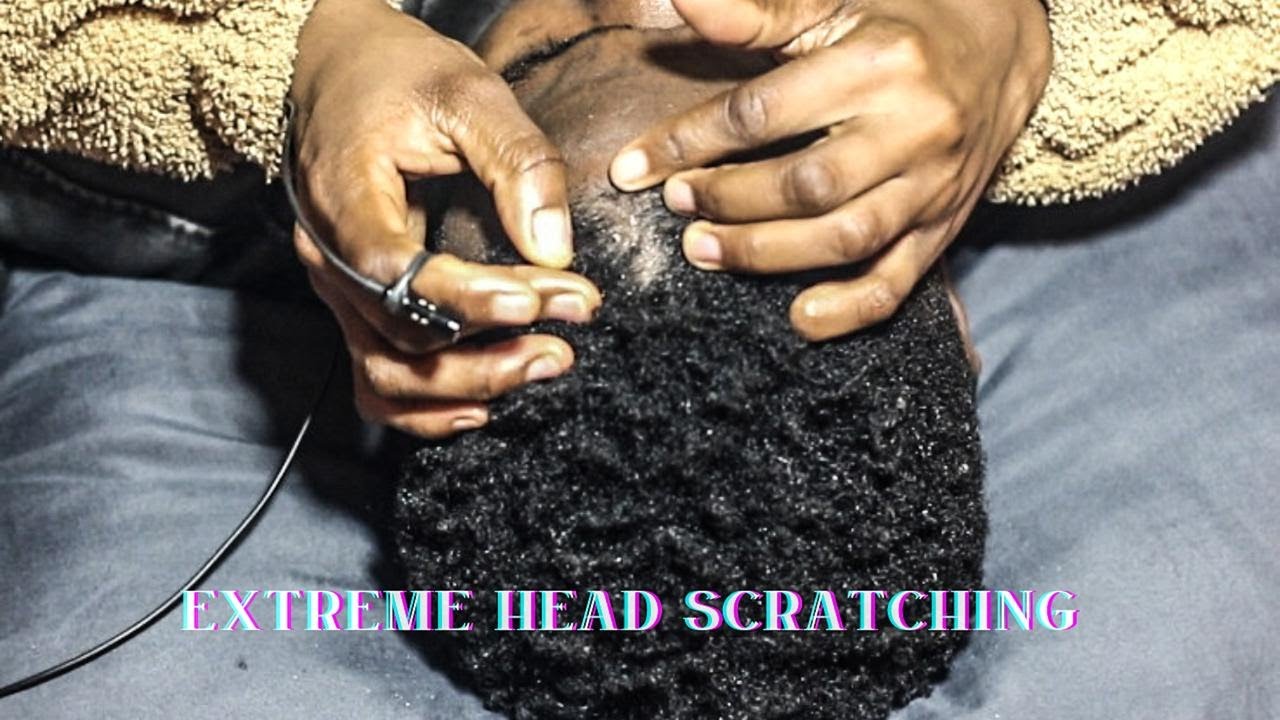 ASMR💫INTENSE SCALP SCRATCH
