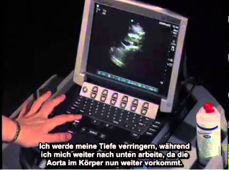 Anleitung: Ultraschalluntersuchung der Bauchaorta