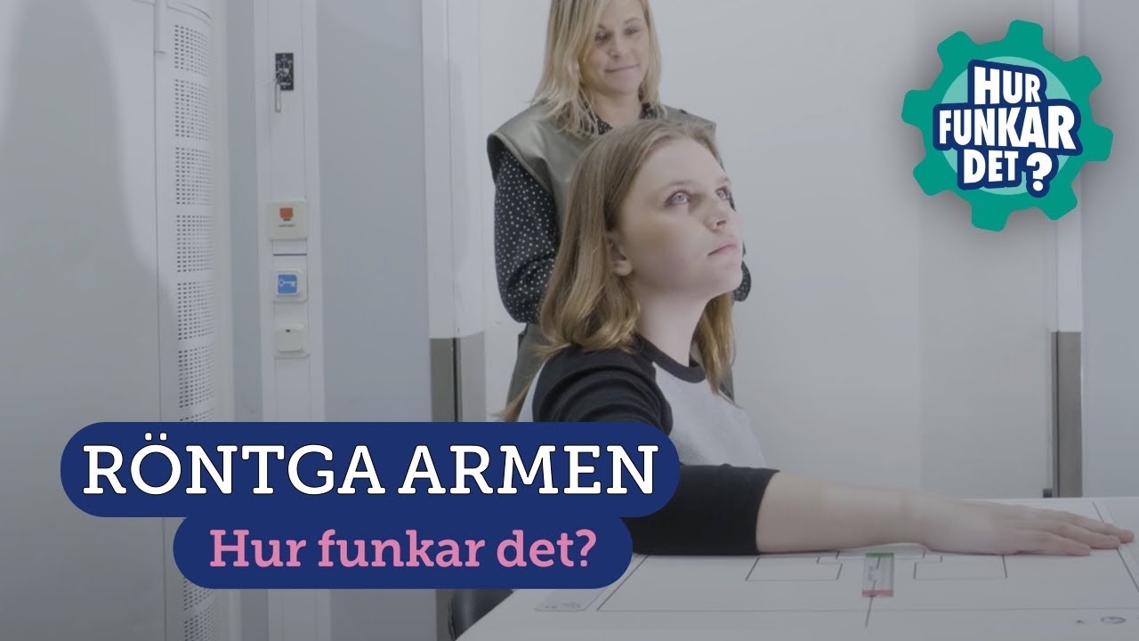 Röntga armen