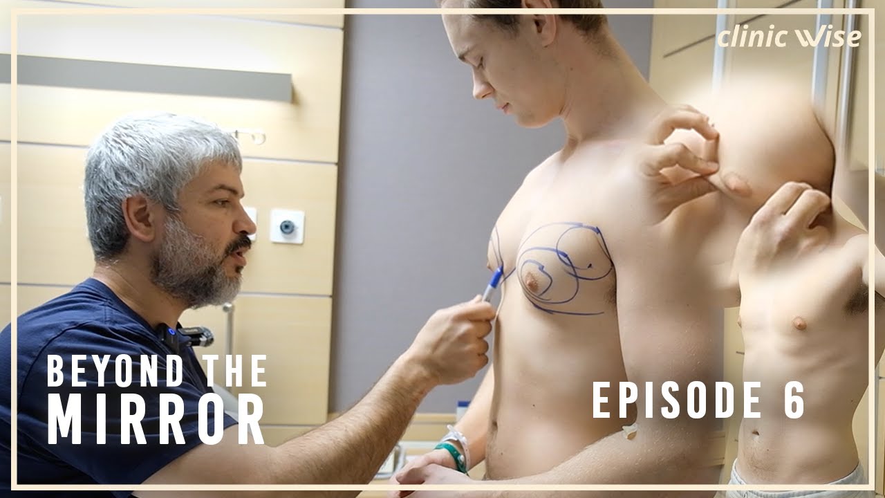 Karl's Journey | GYNECOMASTIA | Beyond the Mirror (Episode 6)