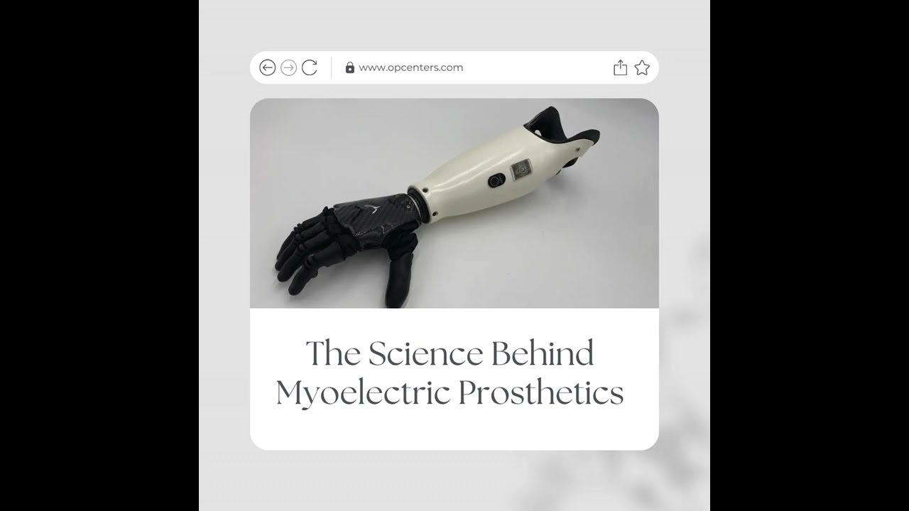 Myoelectric prosthetics are revolutionizing the field!