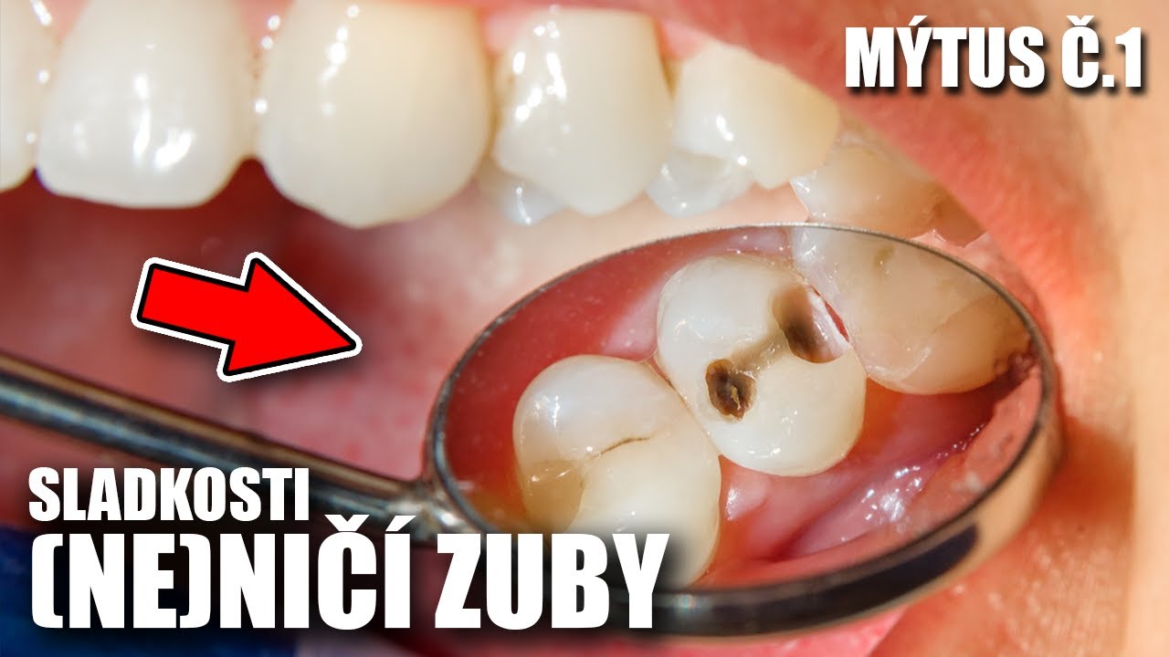 Nejčastější mýty o zubech a péči o chrup