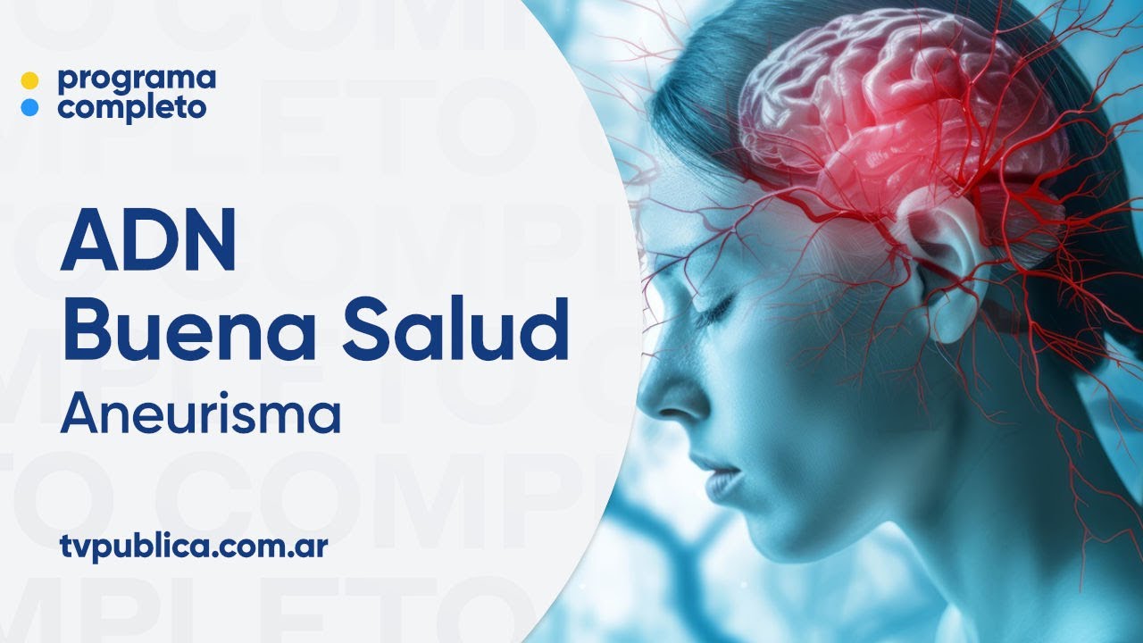 Aneurisma cerebral: el impacto del estilo de vida en la salud cerebral - ADN Buena Salud